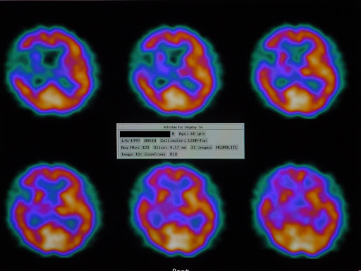 Brain scan 3